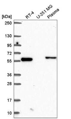 Western Blot: CCDC65 Antibody [NBP2-56860] - Western blot analysis in human cell line RT-4, human cell line U-251 MG and human plasma.