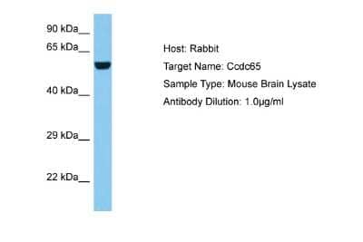 Western Blot: CCDC65 Antibody [NBP2-84617] - Host: Rabbit. Target Name: CCDC65. Sample Tissue: Mouse Brain lysates. Antibody Dilution: 1ug/ml