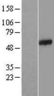 Western Blot: CCDC65 Overexpression Lysate (Adult Normal) [NBL1-08812] Left-Empty vector transfected control cell lysate (HEK293 cell lysate); Right -Over-expression Lysate for CCDC65.