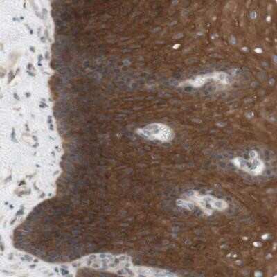 Immunohistochemistry-Paraffin: CCDC67 Antibody [NBP1-93920] - Staining of human esophagus shows strong cytoplasmic positivity in squamous epithelial cells.