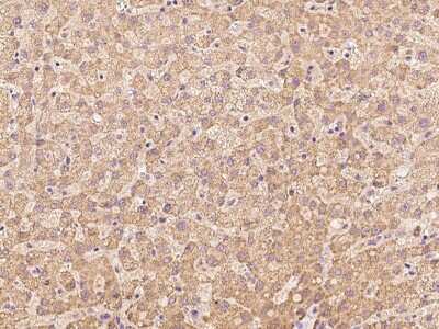 Immunohistochemistry-Paraffin: CCDC67 Antibody [NBP2-98665] - Immunochemical staining of human CCDC67 in human liver with rabbit polyclonal antibody at 1:100 dilution, formalin-fixed paraffin embedded sections.