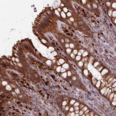 Immunohistochemistry: CCDC68 Antibody [NBP2-47520] - Staining of human colon tissue. Shows strong cytoplasmic positivity in glandular cells.