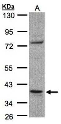Western Blot: CCDC68 Antibody [NBP1-31622] - Sample(30 ug whole cell lysate)A:Raji 10% SDS PAGE, antibody diluted at 1:1000.