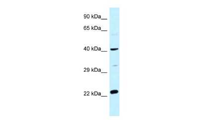 Western Blot: CCDC68 Antibody [NBP2-87151] - WB Suggested Anti-CCDC68 Antibody. Titration: 1.0 ug/ml. Positive Control: Fetal Heart