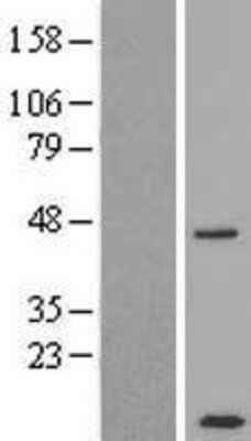 Western Blot: CCDC68 Overexpression Lysate (Adult Normal) [NBP2-09693] Left-Empty vector transfected control cell lysate (HEK293 cell lysate); Right -Over-expression Lysate for CCDC68.