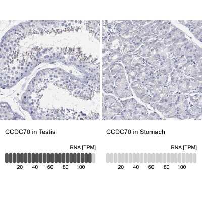 Immunocytochemistry/ Immunofluorescence CCDC70 Antibody - BSA Free