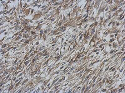 Immunohistochemistry-Paraffin: CCDC70 Antibody [NBP2-15754] - Immunohistochemical analysis of paraffin-embedded C2C12 xenograft, using antibody at 1:500 dilution.