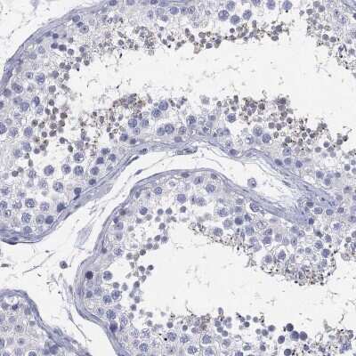 Immunohistochemistry-Paraffin: CCDC70 Antibody [NBP3-17100] - Staining of human testis shows high expression.