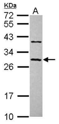 Western Blot CCDC70 Antibody - BSA Free