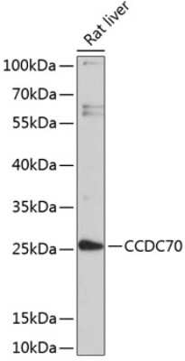 Western Blot CCDC70 Antibody - BSA Free