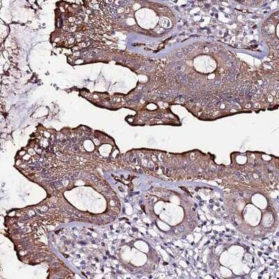 Immunohistochemistry-Paraffin: CCDC71 Antibody [NBP2-14600] - Staining of human rectum shows distinct membranous and cytoplasmic positivity in glandular cells.