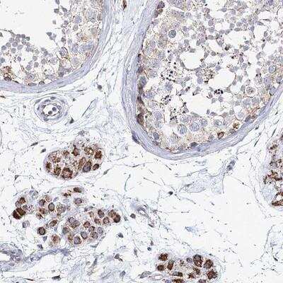 Immunohistochemistry: CCDC73 Antibody [NBP1-90689] - Staining of human testis shows strong granular cytoplasmic positivity in Leydig cells.