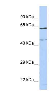 Western Blot: CCDC74A Antibody [NBP1-56895] - MCF-7 whole cell lysates, concentration 0.2-1 ug/ml.