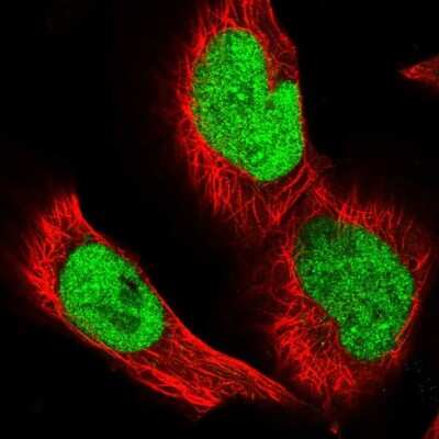 Immunocytochemistry/Immunofluorescence: CCDC75 Antibody [NBP1-93801] - Staining of human cell line U-251 MG shows localization to nucleus. Antibody staining is shown in green.