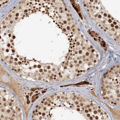 Immunohistochemistry-Paraffin: CCDC75 Antibody [NBP1-93801] - Staining of human testis shows high expression.