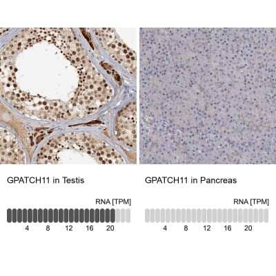 Immunohistochemistry-Paraffin: CCDC75 Antibody [NBP1-93801] - Staining in human testis and pancreas tissues using anti-GPATCH11 antibody. Corresponding GPATCH11 RNA-seq data are presented for the same tissues.