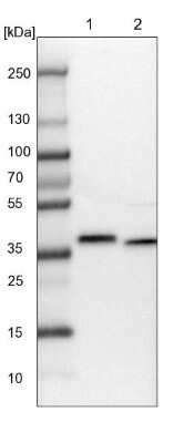 Western Blot: CCDC75 Antibody [NBP1-93801] - Lane 1: NIH-3T3 cell lysate (Mouse embryonic fibroblast cells). Lane 2: NBT-II cell lysate (Rat Wistar bladder tumor cells).