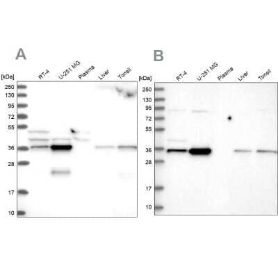 <b>Independent Antibodies Validation and Orthogonal Strategies Validation.</b>Western Blot: CCDC75 Antibody [NBP1-93801] - Analysis using Anti-GPATCH11 antibody NBP1-93801 (A) shows similar pattern to independent antibody NBP2-34044 (B).