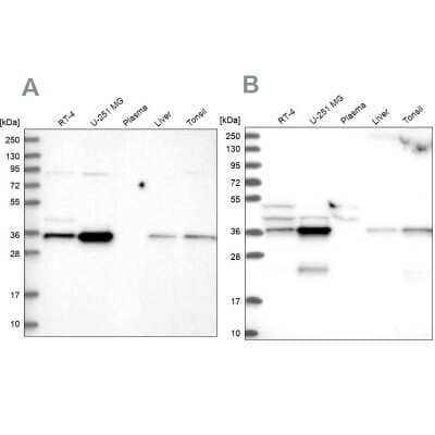 Western Blot: CCDC75 Antibody [NBP2-34044] - Analysis using Anti-GPATCH11 antibody NBP2-34044 (A) shows similar pattern to independent antibody NBP1-93801 (B).