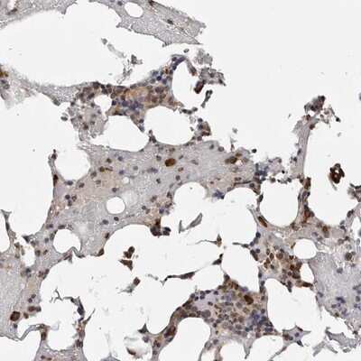 Immunohistochemistry-Paraffin: CCDC76 Antibody [NBP1-84643] - Staining of human bone marrow shows strong cytoplasmic and nuclear positivity in bone marrow poietic cells.