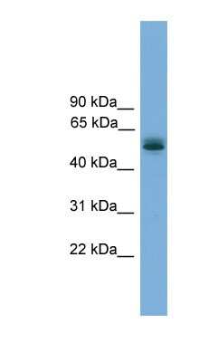 Western Blot: CCDC76 Antibody [NBP1-57022] - Human Lung lysate, concentration 0.2-1 ug/ml.