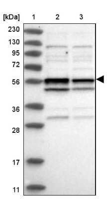 Western Blot: CCDC76 Antibody [NBP1-84643] - Lane 1: Marker  [kDa] 230, 130, 95, 72, 56, 36, 28, 17, 11.  Lane 2: Human cell line RT-4.  Lane 3: Human cell line U-251MG sp