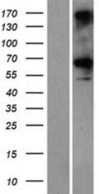 Western Blot: CCDC76 Overexpression Lysate (Adult Normal) [NBP2-06726] Left-Empty vector transfected control cell lysate (HEK293 cell lysate); Right -Over-expression Lysate for CCDC76.
