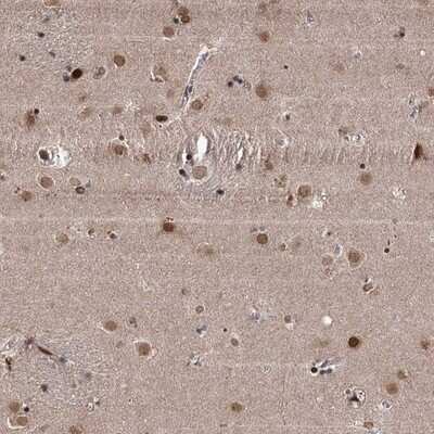 Immunohistochemistry-Paraffin: CCDC77 Antibody [NBP1-93521] - Staining of human lateral ventricle shows moderate nuclear positivity in neuronal cells.