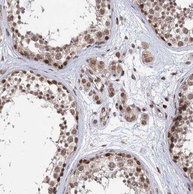 Immunohistochemistry-Paraffin: CCDC77 Antibody [NBP1-93521] - Staining of human testis shows nuclear positivity in testis.