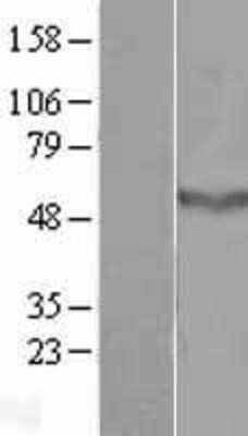 Western Blot CCDC78 Overexpression Lysate