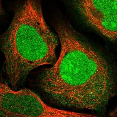 Immunocytochemistry/Immunofluorescence: CCDC82 Antibody [NBP1-83583] - Immunofluorescent staining of human cell line U-2 OS shows localization to nucleus, nucleoli & cytosol.