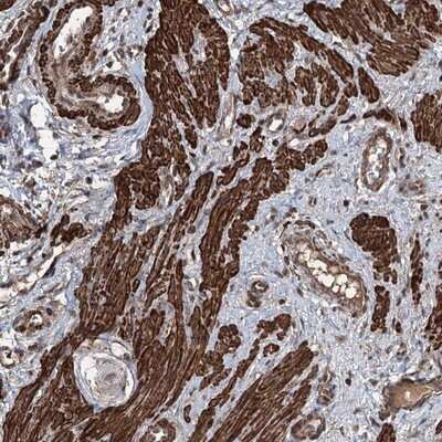 Immunohistochemistry-Paraffin: CCDC82 Antibody [NBP1-83583] - Staining of human smooth muscle shows strong cytoplasmic positivity in smooth muscle cells.