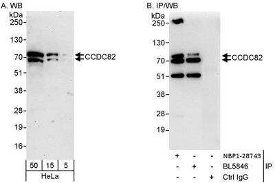 Immunoprecipitation: CCDC82 Antibody [NBP1-28743] - Samples: Whole cell lysate (5, 15 and 50 ug for WB; 1 mg for IP, 20% of IP loaded) from HeLa cells. Antibodies: Affinity purified rabbit anti-CCDC82 antibody used for WB at 0.1 ug/ml (A) and 1 ug/ml (B) and used for IP at 10 ug/mg lysate. CCDC82 was also immunoprecipitated by rabbit anti-CCDC82 antibody BL5846, which recognizes a downstream epitope. Detection: Chemiluminescence with exposure times of 3 minutes (A) and 10 seconds (B).