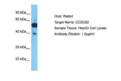 Western Blot: CCDC82 Antibody [NBP2-84623] - Host: Rabbit. Target Name: CCDC82. Sample Type: HepG2 Whole Cell lysates. Antibody Dilution: 1.0ug/ml