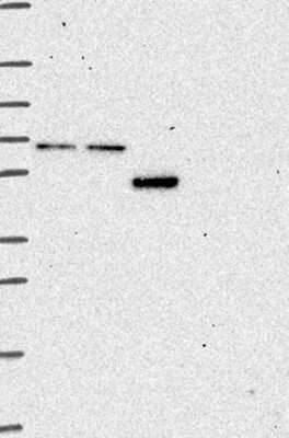 Western Blot: CCDC82 Antibody [NBP3-17223] - Lane 1: Marker [kDa] 250, 130, 95, 72, 55, 36, 28, 17, 10;   Lane 2: RT4;   Lane 3: U-251 MG;   Lane 4: Human Plasma;   Lane 5: Liver;   Lane 6: Tonsil