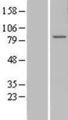 Western Blot: CCDC82 Overexpression Lysate (Adult Normal) [NBL1-08825] Left-Empty vector transfected control cell lysate (HEK293 cell lysate); Right -Over-expression Lysate for CCDC82.
