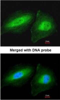 Immunocytochemistry/Immunofluorescence: CCDC83 Antibody [NBP1-32738] - Paraformaldehyde-fixed HeLa, using antibody at 1:200 dilution.