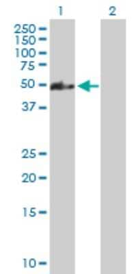 Western Blot: CCDC83 Antibody [H00220047-B01P] - Analysis of CCDC83 expression in transfected 293T cell line by CCDC83 polyclonal antibody.  Lane 1: MGC34732 transfected lysate(45.43 KDa). Lane 2: Non-transfected lysate.