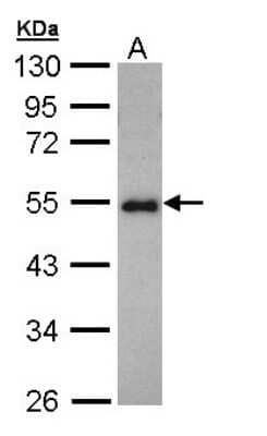 Western Blot: CCDC83 Antibody [NBP1-32738] - Sample (30 ug of whole cell lysate)A: Hep G2  10% SDS PAGE, antibody diluted at 1:1000.
