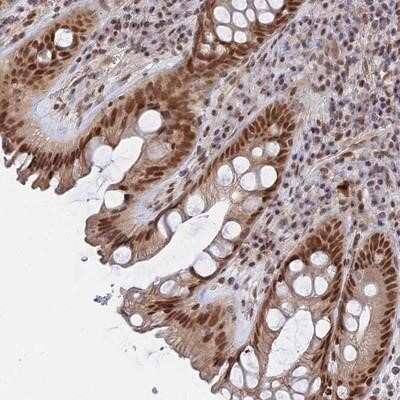 Immunohistochemistry-Paraffin CCDC85A Antibody - BSA Free