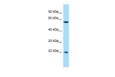 Western Blot CCDC85A Antibody - BSA Free