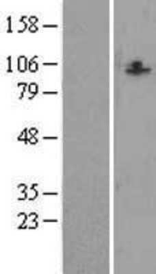 Western Blot: CCDC87 Overexpression Lysate (Adult Normal) [NBL1-08827] Left-Empty vector transfected control cell lysate (HEK293 cell lysate); Right -Over-expression Lysate for CCDC87.