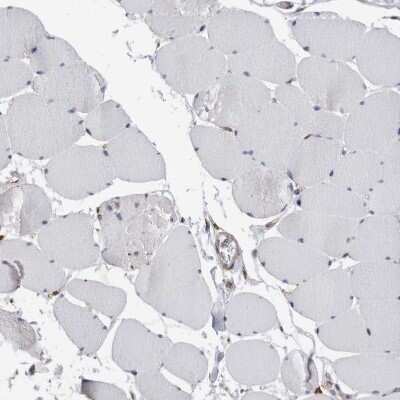 Immunohistochemistry-Paraffin CCDC88B Antibody - BSA Free