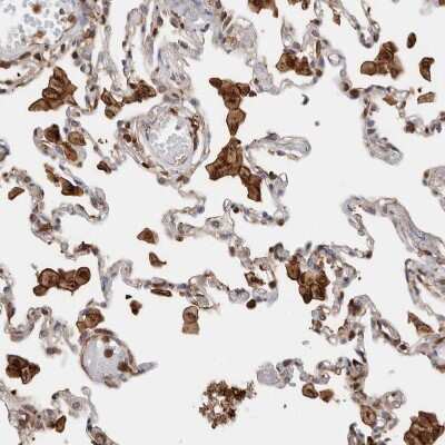 Immunohistochemistry-Paraffin CCDC88B Antibody - BSA Free