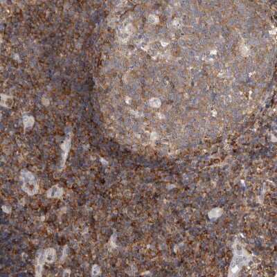 Immunohistochemistry-Paraffin CCDC88B Antibody - BSA Free