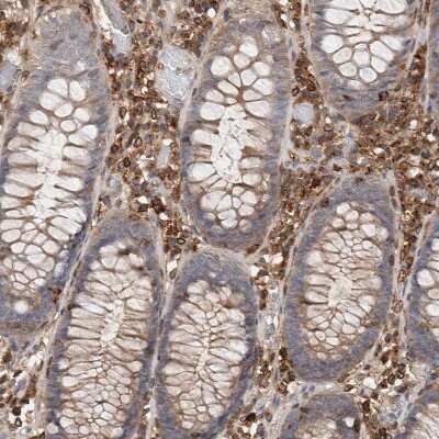 Immunohistochemistry-Paraffin: CCDC88B Antibody [NBP1-88350] - Staining of human colon shows strong cytoplasmic positivity in lymphoid cells.