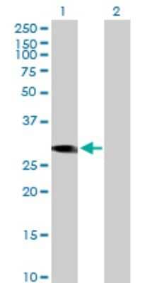Western Blot CCDC88B Antibody - Azide and BSA Free