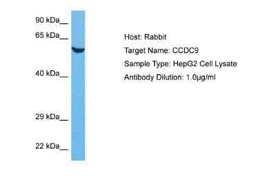 Western Blot: CCDC9 Antibody [NBP2-84630] - Host: Rabbit. Target Name: CCDC9. Sample Tissue: Human HepG2 Whole Cell lysates. Antibody Dilution: 1ug/ml