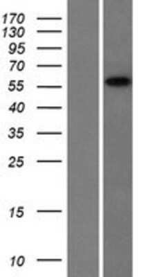 Western Blot: CCDC9 Overexpression Lysate (Adult Normal) [NBL1-08829] Left-Empty vector transfected control cell lysate (HEK293 cell lysate); Right -Over-expression Lysate for CCDC9.