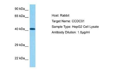 Western Blot: CCDC91 Antibody [NBP2-84632] - Host: Rabbit. Target Name: CCDC91. Sample Tissue: Human HepG2 Whole Cell lysates. Antibody Dilution: 1ug/ml